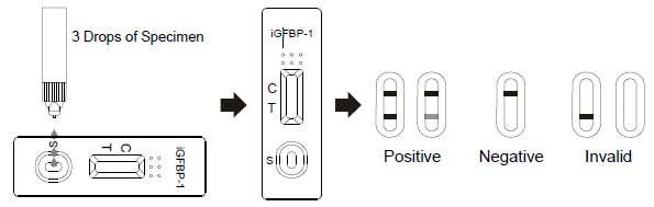 Πλευρικές δοκιμές AllTest Immunochromatographic ροής iGFBP-1 γρήγορη κασέτα δοκιμής στην κολπική απαλλαγή