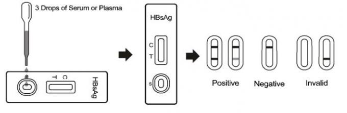 ISO13485/CE HBsAg γρήγορος δοκιμής cOem ευαισθησίας εξαρτήσεων υψηλός διαθέσιμος με τον ορό/το πλάσμα