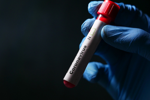 Τελευταίες εταιρικές ειδήσεις για SAR-CoV-2 κατώτατο όριο κύκλων: Ένας μετρικός που πειράζει (ή όχι)