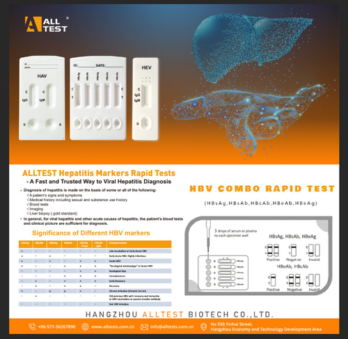 Latest company news about Τι συμπτώματα ηπατίτιδας μοιάζει με στα παιδιά;