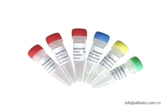 Good price Πραγματικός - χρόνος Allchek SAR-cov-2 Rt Qpcr δοκιμή σε απευθείας σύνδεση